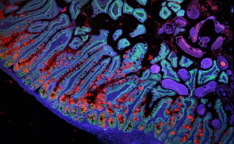 Grace Burgin, Noga Rogel & Moshe Biton, Klarman Cell Observatory, Broad Institute.png A section showing how many genes are turned on to develop the lower intestine