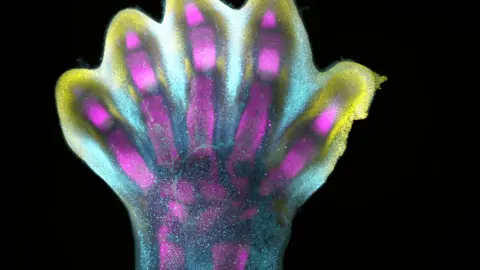 Alain Chédotal and Raphaël Blain, Inserm A developing human foot. Dots of different colours are genes building bone, muscle and cartilage