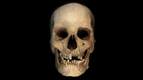 Liverpool John Moores University. Nature A stark, white human skull is depicted against a black Backround
